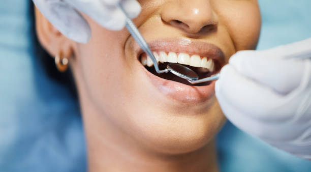 Best Cosmetic Emergency Dentistry in Hope Valley, RI