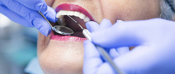 Best Emergency Tooth Extraction in Hope Valley, RI